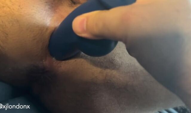 POINT OF VIEW: Using Fake-manmeat to Open Postop FTM Vag